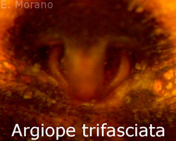 epigino