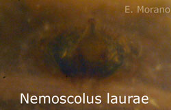 epigino