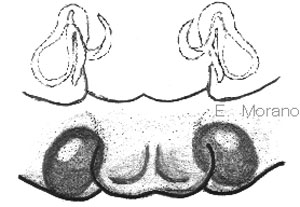 epigino
